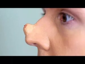 Уплотнение на носу