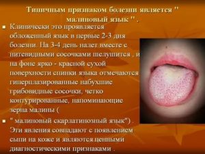 Язык малиновый при каком заболевании