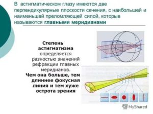 Какая разница рефракции в двух главных меридианах в дптр (астигматизм)