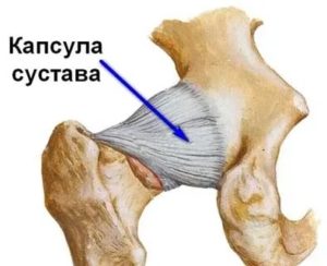 Разрыв суставной капсулы