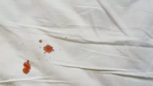 Не было крови при первом половом акте