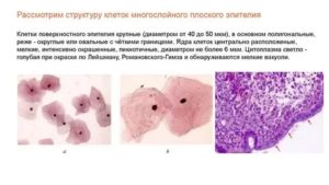 Цитологическое исследование. Паракератоз плоского эпителия
