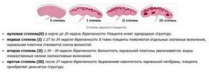 Старение плаценты