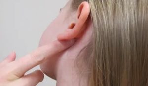 Зудящая мокнущая сыпь на ухе