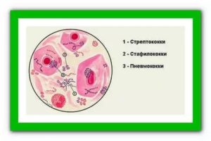 Лечение пневмококка и зол. Стафилококка