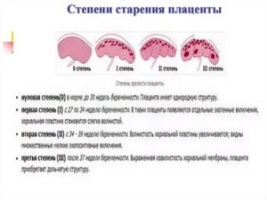 Старение плаценты