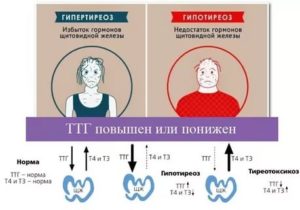 Повышенный уровень ТТГ