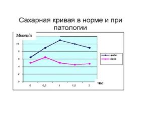 Сахарная кривая в беременность