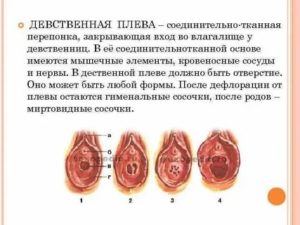 Как увидеть самостоятельно девственную плеву?