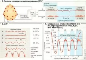 Расшифровка ЭЭГ в динамике