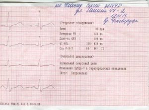 Срок годности ЭКГ с нагрузкой