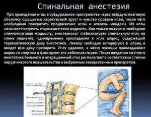 После спинальной анестезии сильно болит шея и голова