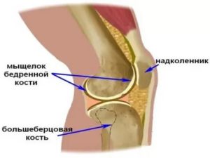 Травма колена, контузионные изменения бедренной кости