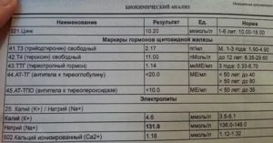 АТ ТПО =354.3* Ед/мл