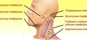 Увеличены шейные, затылочные и подчелюстные лимфоузлы