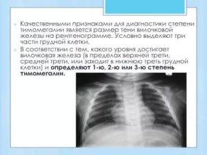 Сделали рентген грудной клетки и обнаружили увеличение вилочковой железы