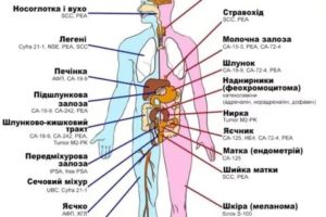 Повышен СА 72-4 может это быть онкология?