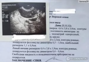На 15 день цикла фолликул 25 мм, эндометрий 8!