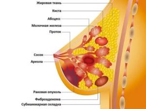 Отмена Ярины при обнаруженной мастопатии