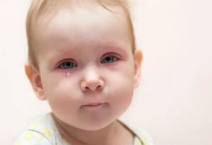 Слезится один глаз у ребёнка