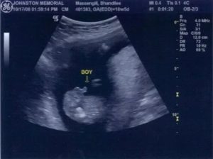 Какой срок ставят на узи акушерские или эмбриональный