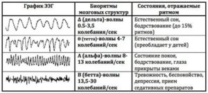 Помогите расшифровать результаты ЭЭГ