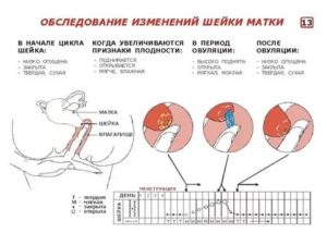 Мягкая матка что это?