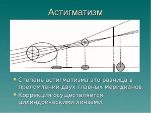 Какая разница рефракции в двух главных меридианах в дптр (астигматизм)