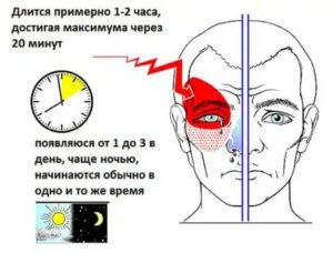 Головная боль в правой части головы, отдает в правый глаз