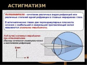 Какая разница рефракции в двух главных меридианах в дптр (астигматизм)