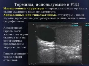 Структура яичника гипоэхогенная