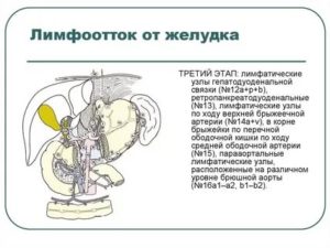 Лимфоузел в гепатодуоденальной связке