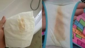 Светло-желтые выделения в середине цикла