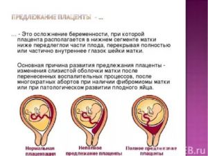 Может ли плацента опуститься