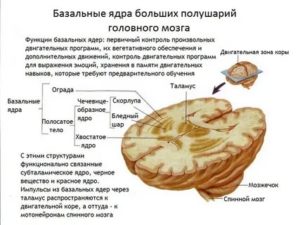 Симметричные мелкие гиперденсивные включения в области базальных ядер