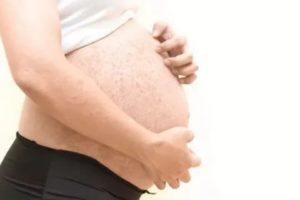 Сыпь и зуд во время беременности