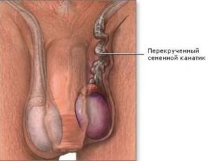 Можно ли травмировать яички во время секса