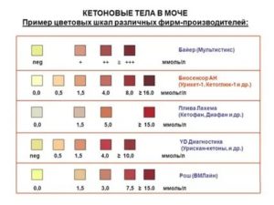 Кетоны в моче у беременной