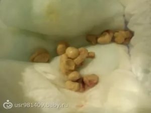 Плохо ест, срыгивания, пукает с калом, постоянно плачет, плохо спит