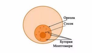 Потемнение ареолов