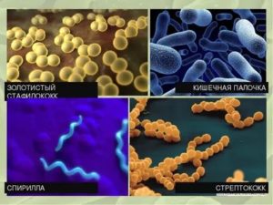 К какой группе бактерий относится Streptococcus faecalis