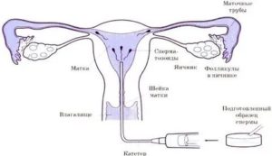 Сперма вытекает из влагалища и вероятность беременности