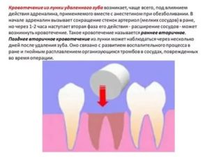 Анализы крови после удаления зуба мудрости