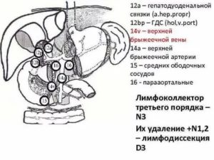 Лимфоузел в гепатодуоденальной связке