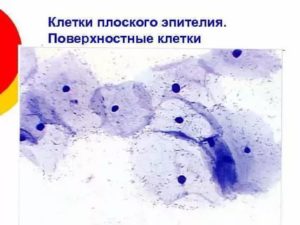 Цитологическое исследование. Паракератоз плоского эпителия