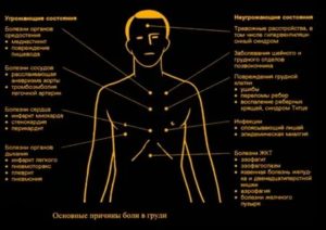 Щемящие, колющие боли в области левого соска