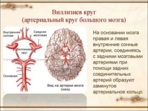 Развитие виллизиева круга в виде снижения кровотока и сужение артериям