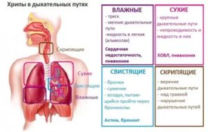 Свист при дыхании у ребенка, кашля нет