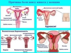 Не болит живот перед месячными