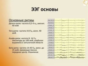 Плахое ЭЭГ, при задержке речевого развития